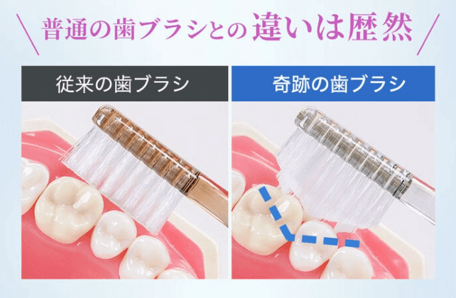 ピラミッド形状が歯と歯の隙間にフィット！